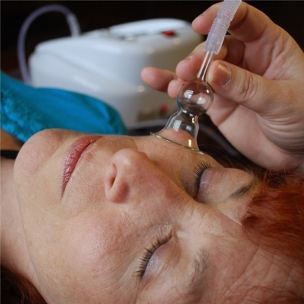 Face Lift Cupping Massage